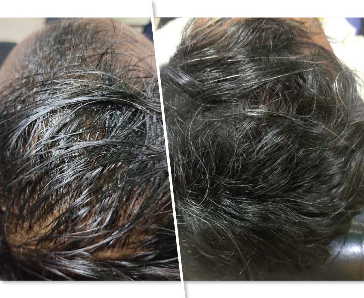 Hair Strengthening Before and After Picture
